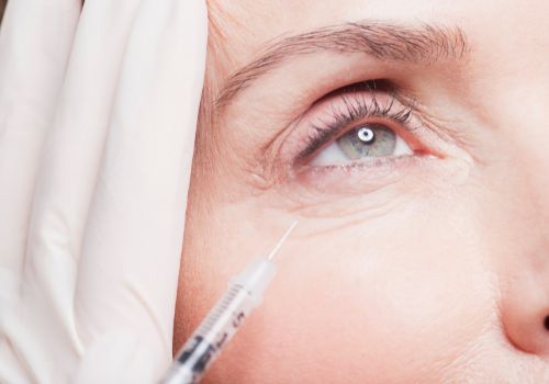 Eyelid Surgery