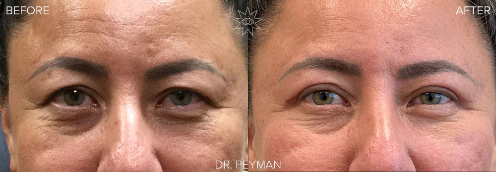 before and after photo
