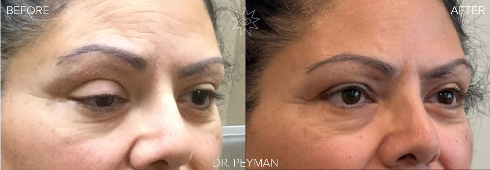 Before and after photo of a patient with